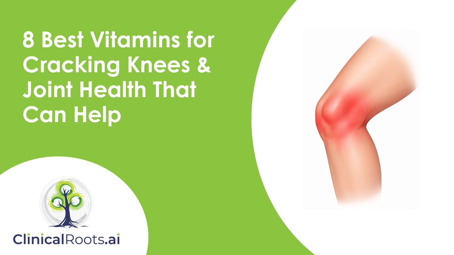 8 Best Vitamins for Cracking Knees & Joint Health That Can Help