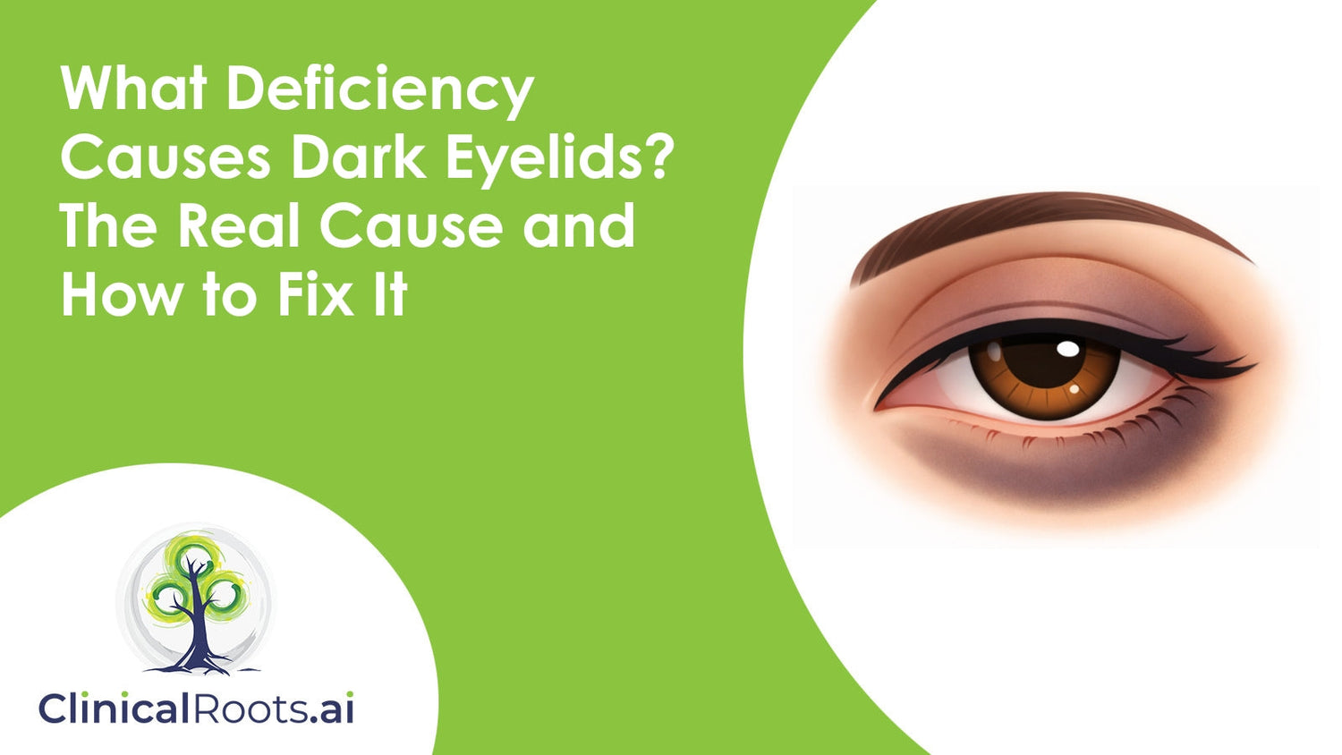 What Deficiency Causes Dark Eyelids? The Real Cause and How to Fix It